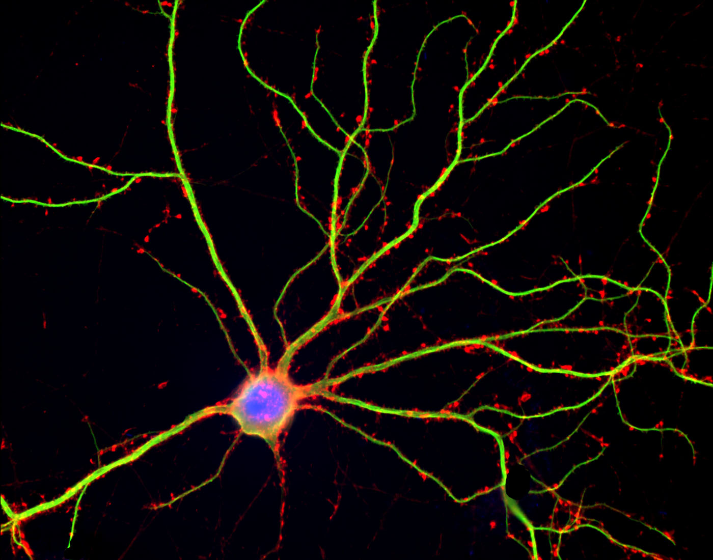 Pictures Of Neuron In Brain 12