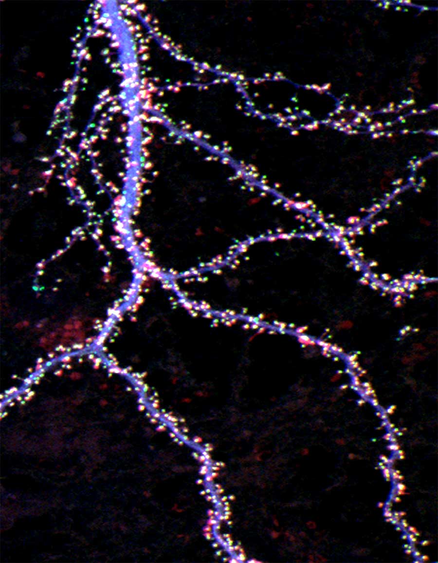 advanced fluorescence microscopy of synapses.