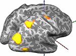 Image of brain