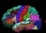 Image of a Brain