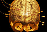Photo of a skull