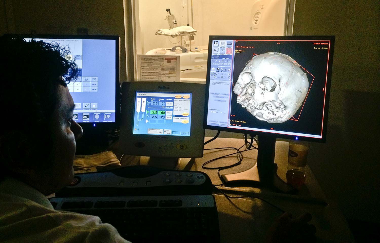 CT scan of Naia's cranium