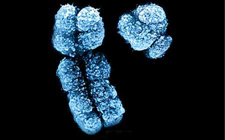 Image: Colorized scanning electron micrograph of X and Y chromosomes.