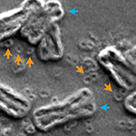 How broken chromosomes make cancer cells resistant to drugs