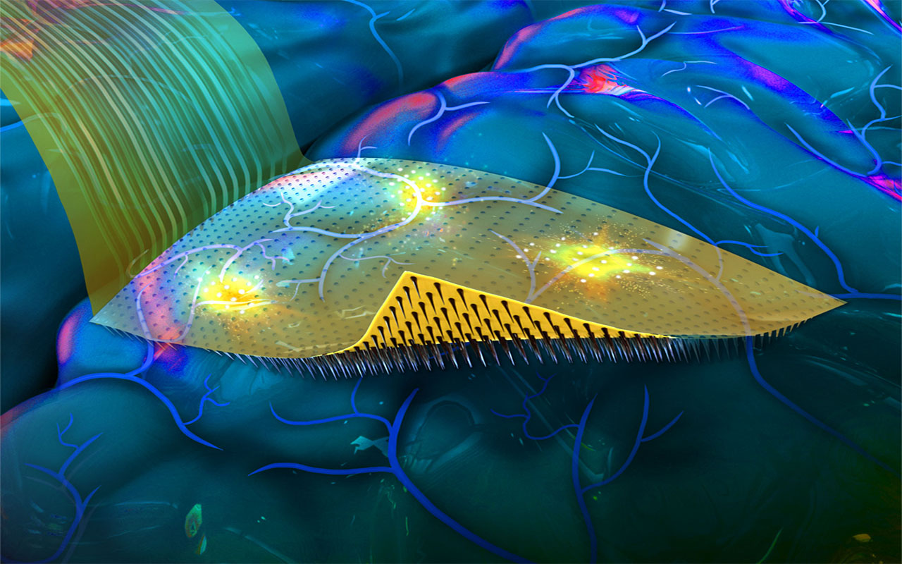 Artist rendition of the flexible, conformable, transparent backing of the new brain-computer interface with penetrating microneedles developed by a team led by engineers at the University of California San Diego in the laboratory of electrical engineering professor Shadi Dayeh. The smaller illustration at bottom left shows the current technology in experimental use called Utah Arrays.
