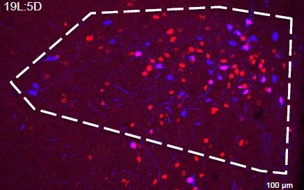 Image reveals the activity of PaVN neurons in rats that were exposed to light mimicking a longer-than-usual day that elicits stressed behaviors.