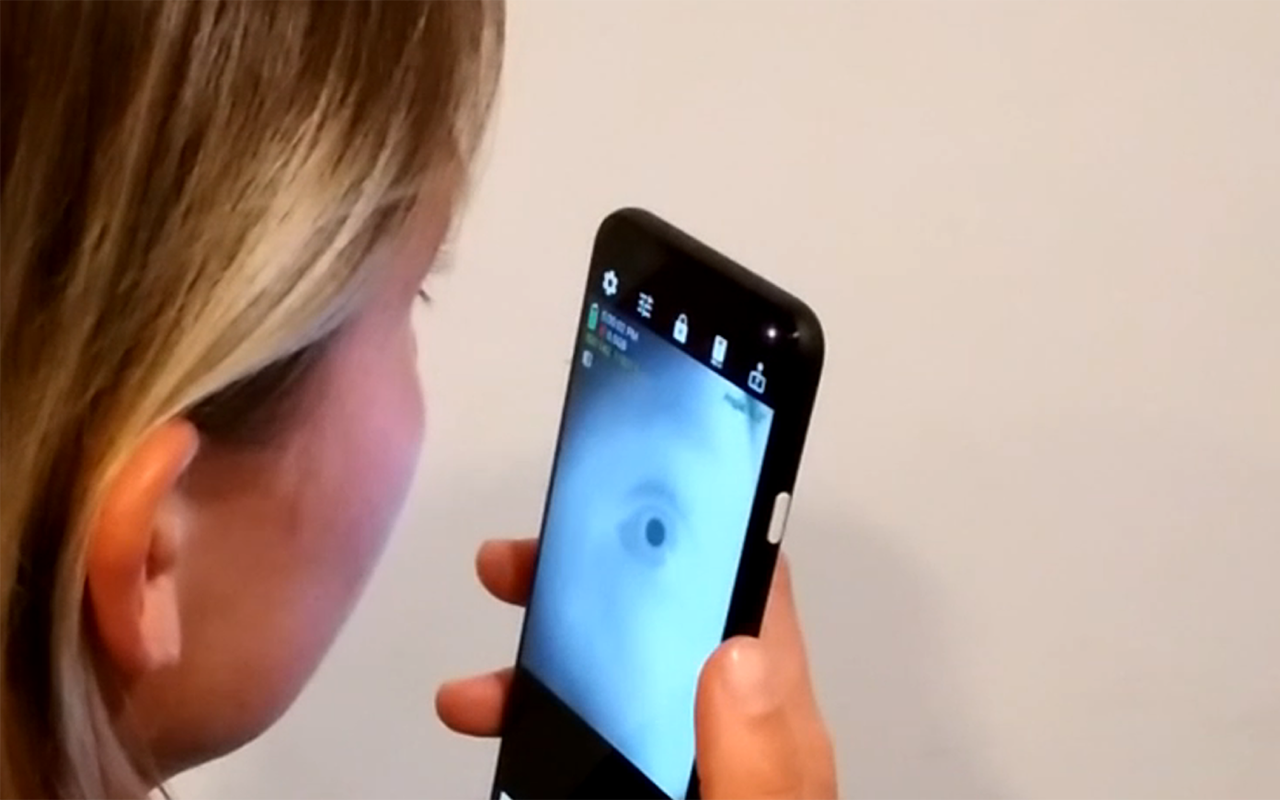 Person takes a selfie image of their eye using their smartphone.