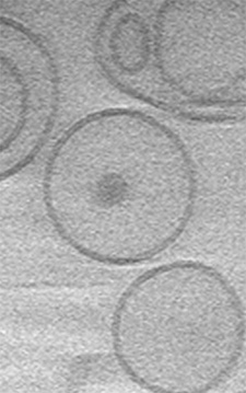 Image: Protective embranes surround tiny particles of an anti-cancer drug in this cryoEM image